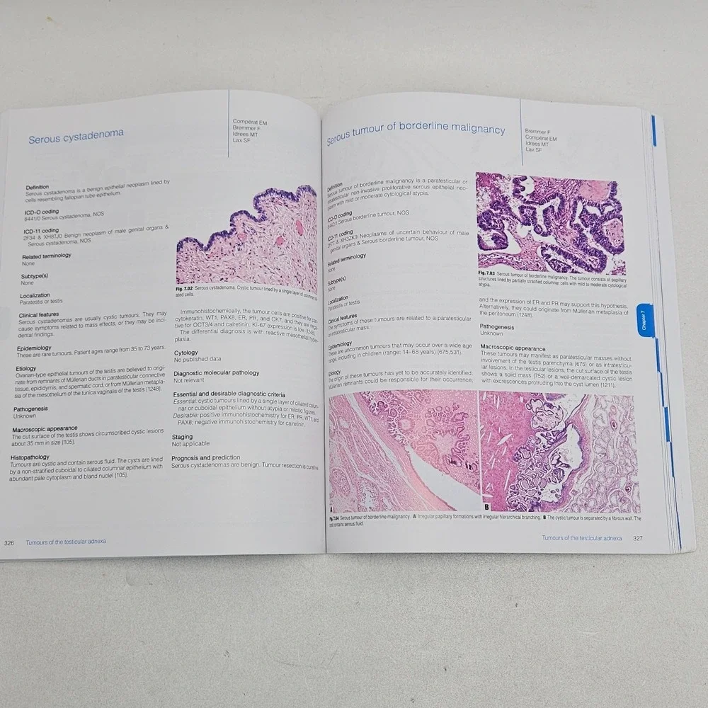 WHO Classification of Tumours 5th Ed. Urinary and Male Genital Tumours Paperback